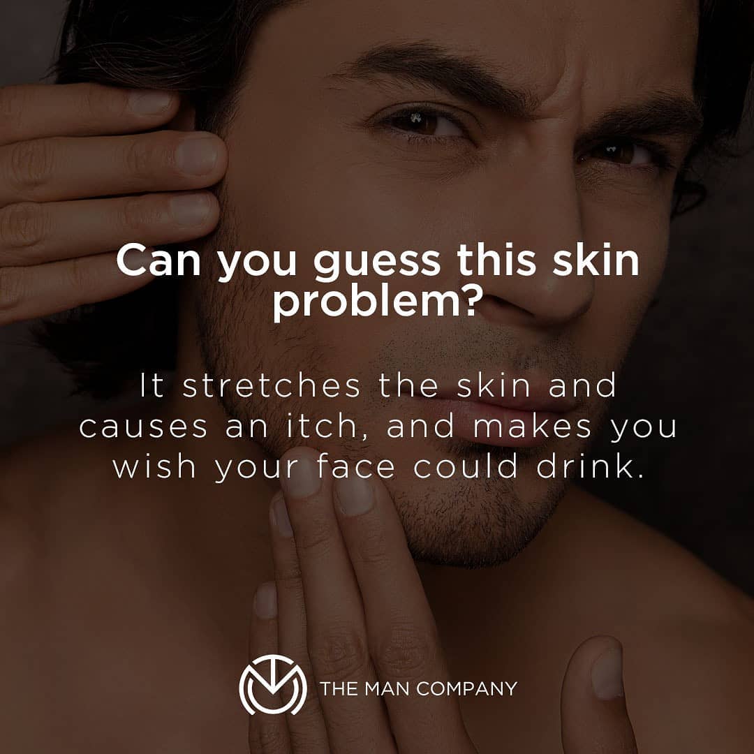 The Man Company - A hint: We've all had it at some point in our lives when our face feels parched.

And you can cure it by using our Vitamin C Face Serum.
#themancompany #GentlemanInYou #guess #game #...